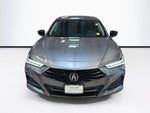 2025 Acura TLX Technology Package