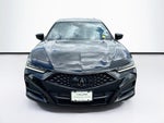2022 Acura TLX A-Spec Package
