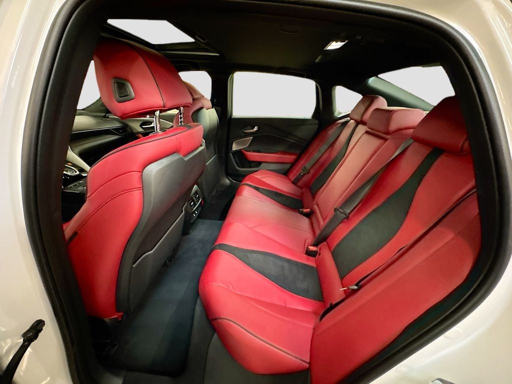 2025 Acura TLX A-Spec Package SH-AWD